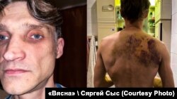 Дзьмітры Чарныш пасьля зьбіцьця